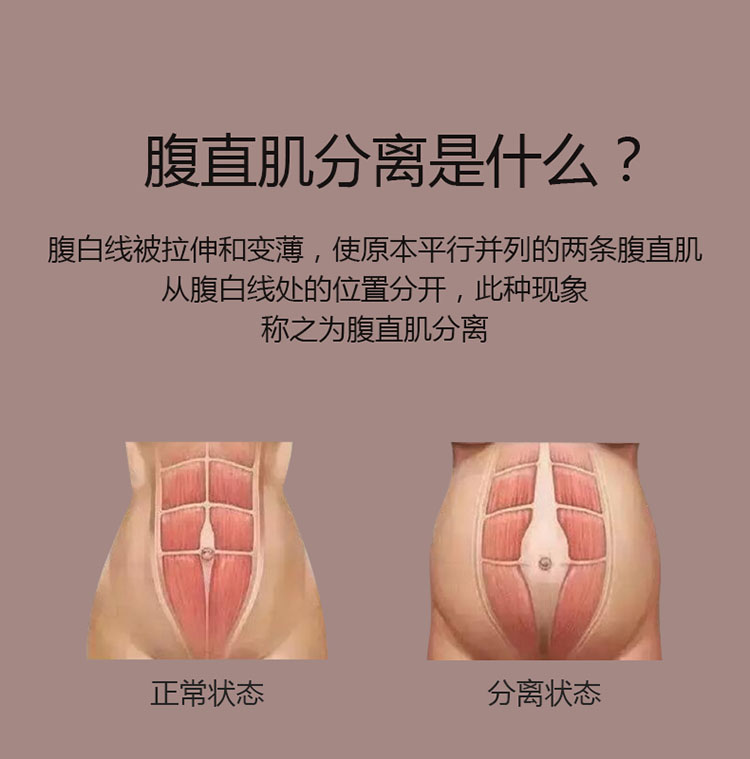 麻麻康腹直肌贴片详情图3.jpg